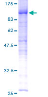ab164143 on a 12.5% SDS-PAGE stained with Coomassie Blue.