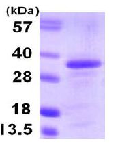 ab107144 at 3 µg analysed by 15% SDS PAGE.