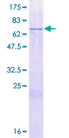 ab164262 on a 12.5% SDS-PAGE stained with Coomassie Blue.