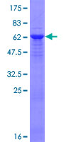 ab153507 on a 12.5% SDS-PAGE stained with Coomassie Blue.