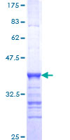 ab161194 on a 12.5% SDS-PAGE stained with Coomassie Blue.