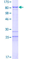 ab163938 on a 12.5% SDS-PAGE stained with Coomassie Blue.