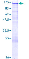 ab153476 on a 12.5% SDS-PAGE stained with Coomassie Blue.