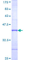 ab153477 on a 12.5% SDS-PAGE stained with Coomassie Blue.