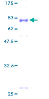 ab163049 on a 12.5% SDS-PAGE stained with Coomassie Blue.