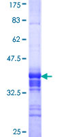 ab163050 on a 12.5% SDS-PAGE stained with Coomassie Blue.