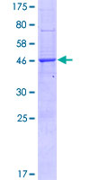 ab165475 on a 12.5% SDS-PAGE stained with Coomassie Blue.