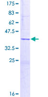 ab161822 on a 12.5% SDS-PAGE stained with Coomassie Blue.