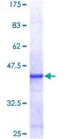 ab161823 on a 12.5% SDS-PAGE stained with Coomassie Blue.