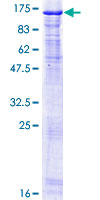 ab161625 on a 12.5% SDS-PAGE stained with Coomassie Blue.