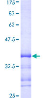 ab161626 on a 12.5% SDS-PAGE stained with Coomassie Blue.