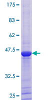 ab160298 on a 12.5% SDS-PAGE stained with Coomassie Blue.