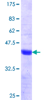 ab159890 on a 12.5% SDS-PAGE stained with Coomassie Blue.