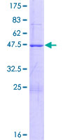 ab162856 on a 12.5% SDS-PAGE stained with Coomassie Blue.