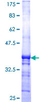 ab162681 on a 12.5% SDS-PAGE stained with Coomassie Blue.
