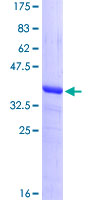 ab163159 on a 12.5% SDS-PAGE stained with Coomassie Blue.