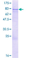 ab161470 on a 12.5% SDS-PAGE stained with Coomassie Blue.