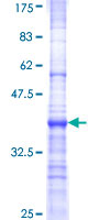 ab165030 on a 12.5% SDS-PAGE stained with Coomassie Blue.