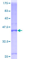 ab157977 on a 12.5% SDS-PAGE stained with Coomassie Blue.