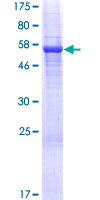 ab161301 on a 12.5% SDS-PAGE stained with Coomassie Blue.
