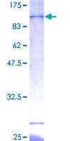 ab160970 on a 12.5% SDS-PAGE stained with Coomassie Blue.