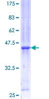 ab160251 on a 12.5% SDS-PAGE stained with Coomassie Blue.