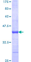 ab160252 on a 12.5% SDS-PAGE stained with Coomassie Blue.