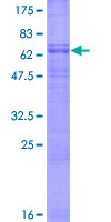 ab161323 on a 12.5% SDS-PAGE stained with Coomassie Blue.
