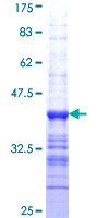 ab161324 on a 12.5% SDS-PAGE stained with Coomassie Blue.