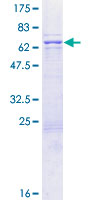 ab160608 on a 12.5% SDS-PAGE stained with Coomassie Blue.