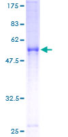ab159473 on a 12.5% SDS-PAGE stained with Coomassie Blue.