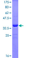 ab158795 on a 12.5% SDS-PAGE stained with Coomassie Blue.
