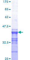 ab158934 on a 12.5% SDS-PAGE stained with Coomassie Blue.