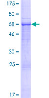ab165500 on a 12.5% SDS-PAGE stained with Coomassie Blue.