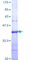 ab165501 on a 12.5% SDS-PAGE stained with Coomassie Blue.
