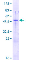 ab163390 on a 12.5% SDS-PAGE stained with Coomassie Blue.