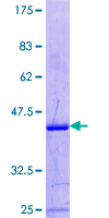 ab163391 on a 12.5% SDS-PAGE stained with Coomassie Blue.