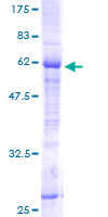 ab162252 on a 12.5% SDS-PAGE stained with Coomassie Blue.