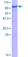ab164214 on a 12.5% SDS-PAGE stained with Coomassie Blue.