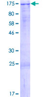 ab166140 on a 12.5% SDS-PAGE stained with Coomassie Blue.