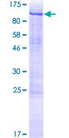 ab164082 on a 12.5% SDS-PAGE stained with Coomassie Blue.