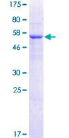 ab165080 on a 12.5% SDS-PAGE stained with Coomassie Blue.