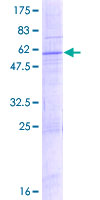 ab166143 on a 12.5% SDS-PAGE stained with Coomassie Blue.