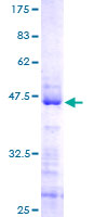 ab162451 on a 12.5% SDS-PAGE stained with Coomassie Blue.