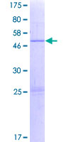 ab163408 on a 12.5% SDS-PAGE stained with Coomassie Blue.
