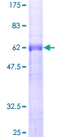 ab164106 on a 12.5% SDS-PAGE stained with Coomassie Blue.
