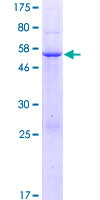 ab166052 on a 12.5% SDS-PAGE stained with Coomassie Blue.
