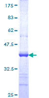 ab163622 on a 12.5% SDS-PAGE stained with Coomassie Blue.