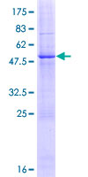 ab166070 on a 12.5% SDS-PAGE stained with Coomassie Blue.