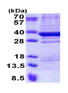 15% SDS-PAGE analysis of ab171590 at 3µg.